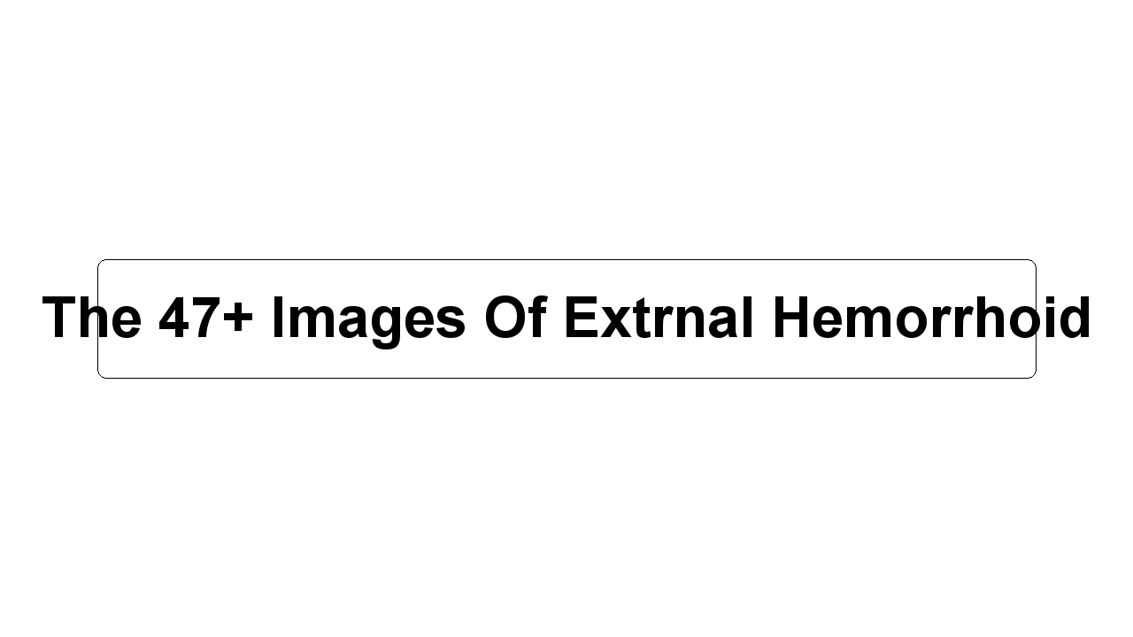 The 47+ Images Of Extrnal Hemorrhoid