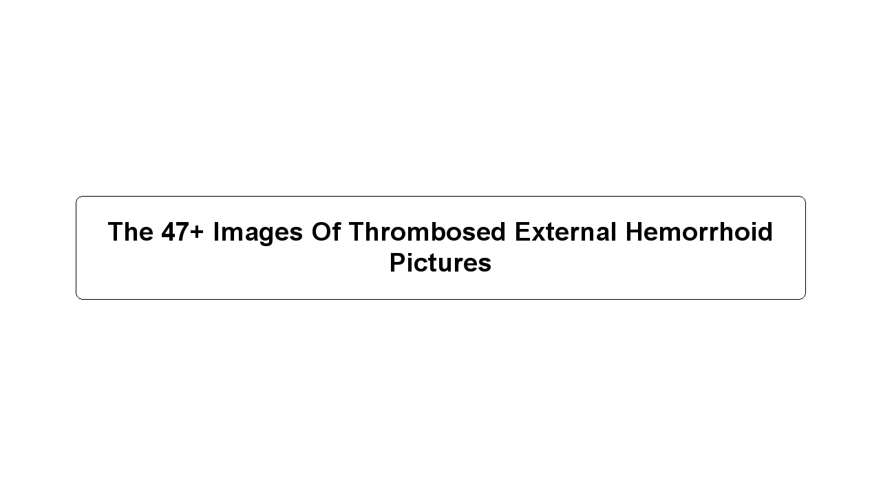 The 47+ Images Of Thrombosed External Hemorrhoid Pictures