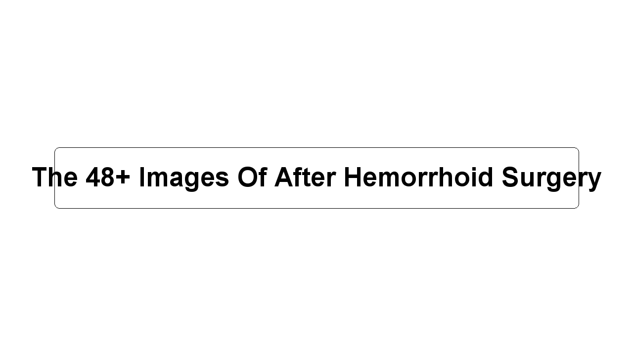 The 48+ Images Of After Hemorrhoid Surgery