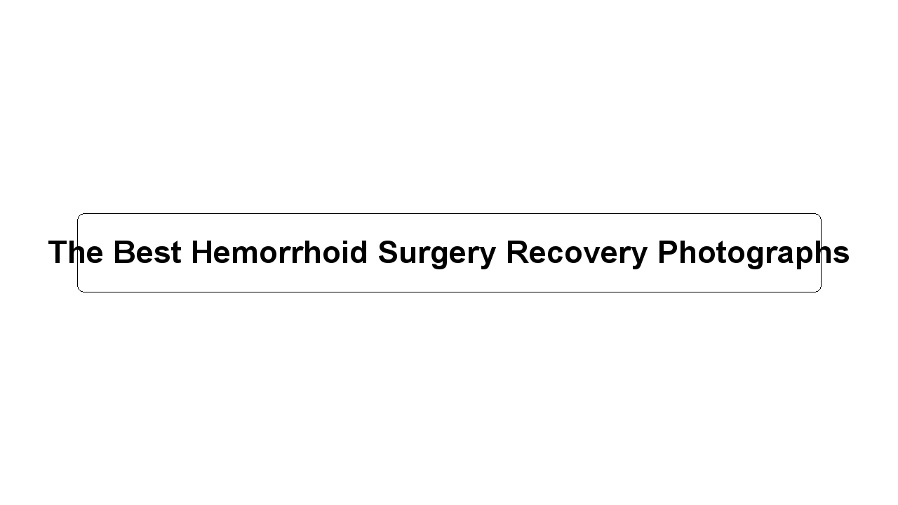 The Best Hemorrhoid Surgery Recovery Photographs