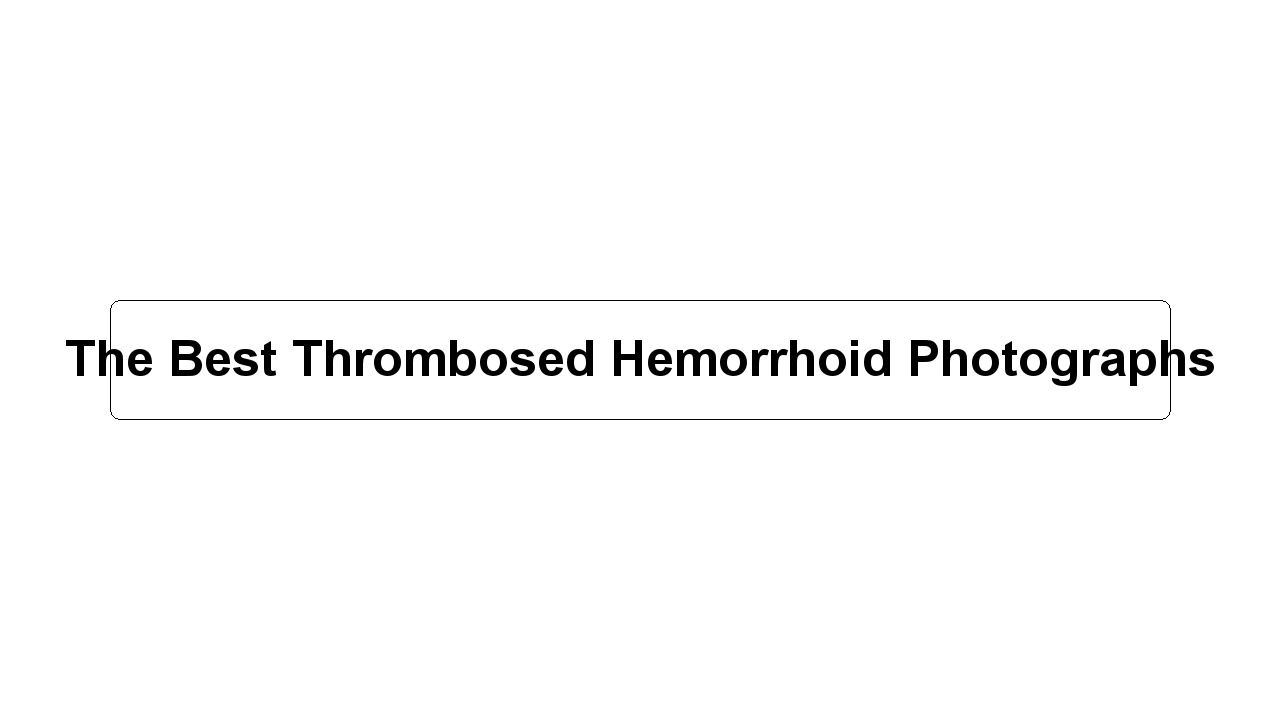 The Best Thrombosed Hemorrhoid Photographs