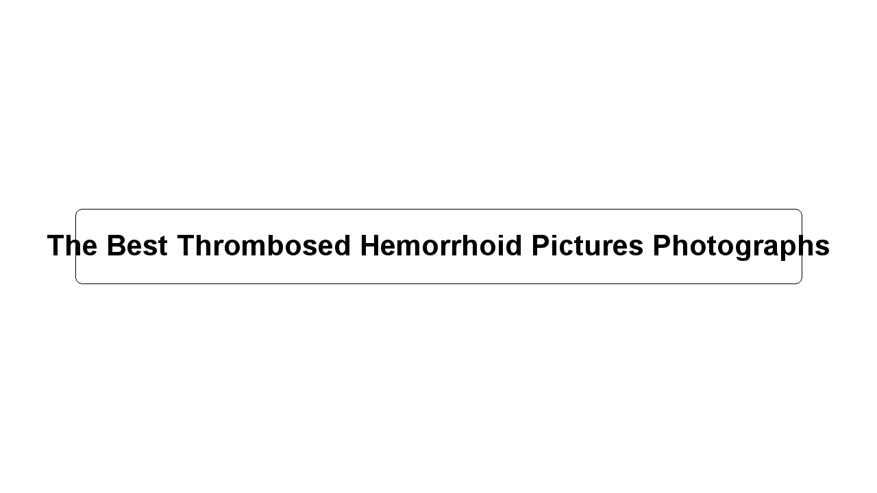 The Best Thrombosed Hemorrhoid Pictures Photographs