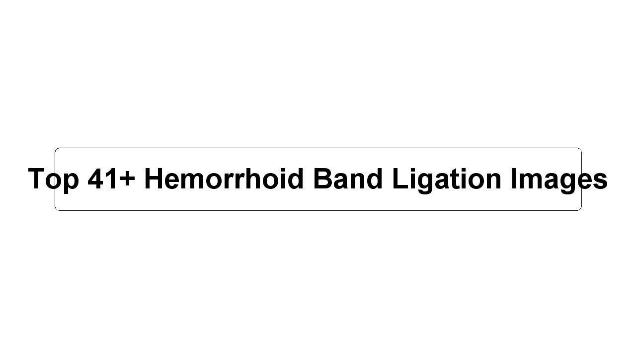 Top 41+ Hemorrhoid Band Ligation Images