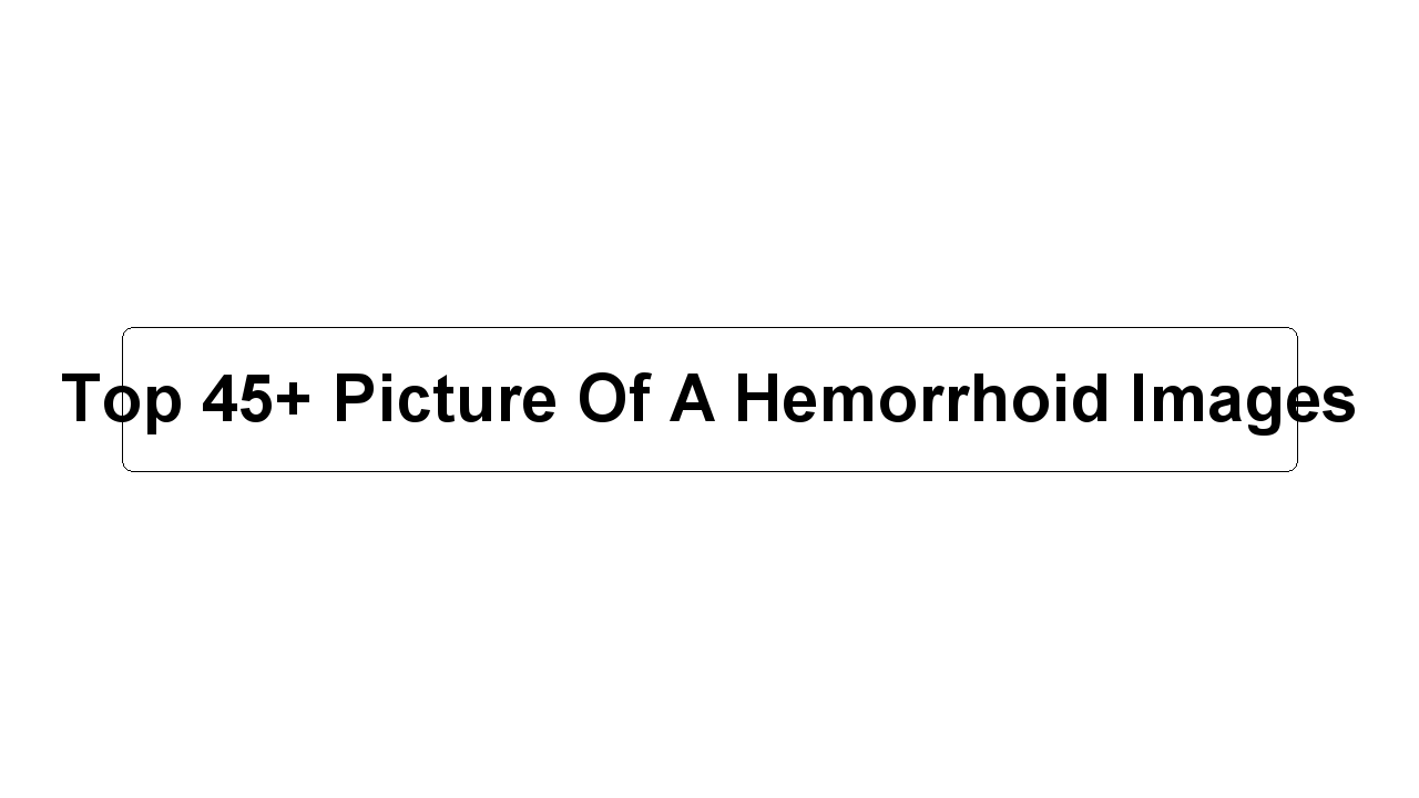 Top 45+ Picture Of A Hemorrhoid Images