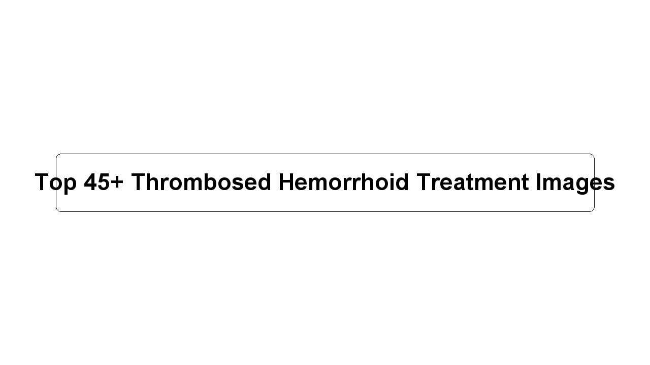 Top 45+ Thrombosed Hemorrhoid Treatment Images