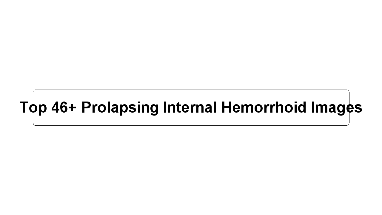 Top 46+ Prolapsing Internal Hemorrhoid Images