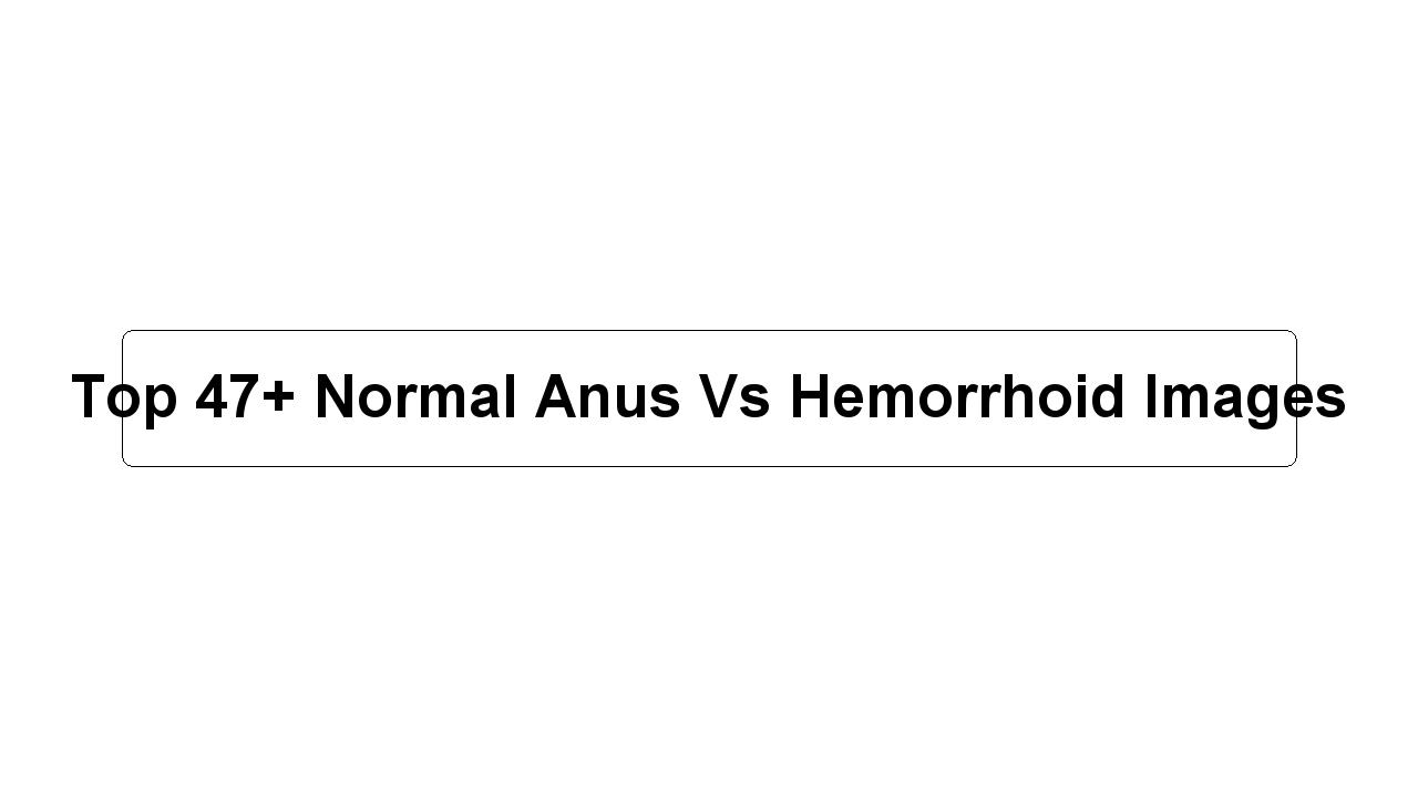 Top 47+ Normal Anus Vs Hemorrhoid Images