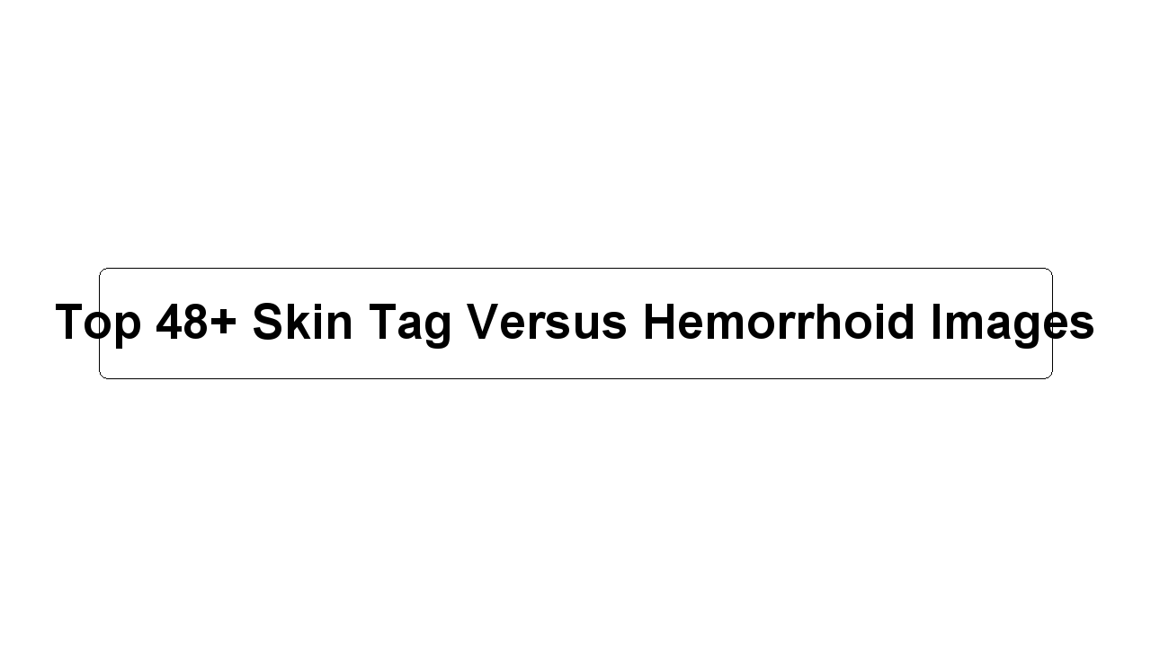 Top 48+ Skin Tag Versus Hemorrhoid Images