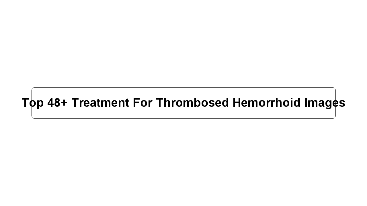 Top 48+ Treatment For Thrombosed Hemorrhoid Images