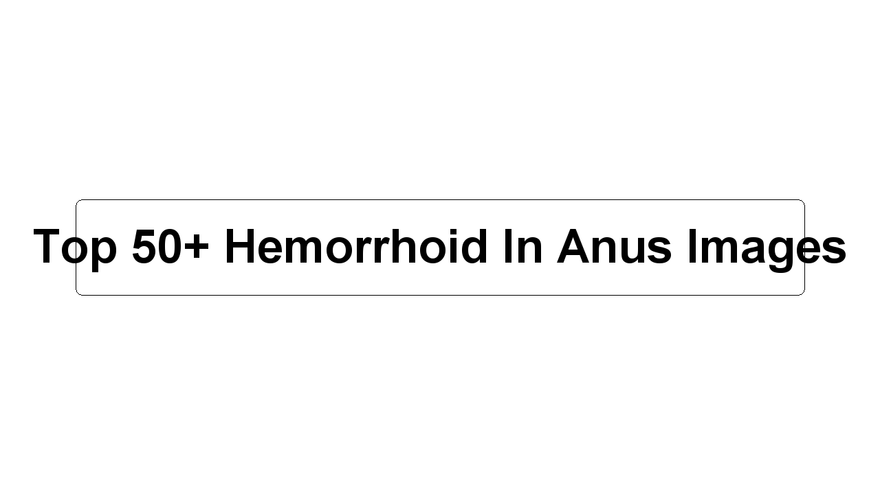 Top 50+ Hemorrhoid In Anus Images